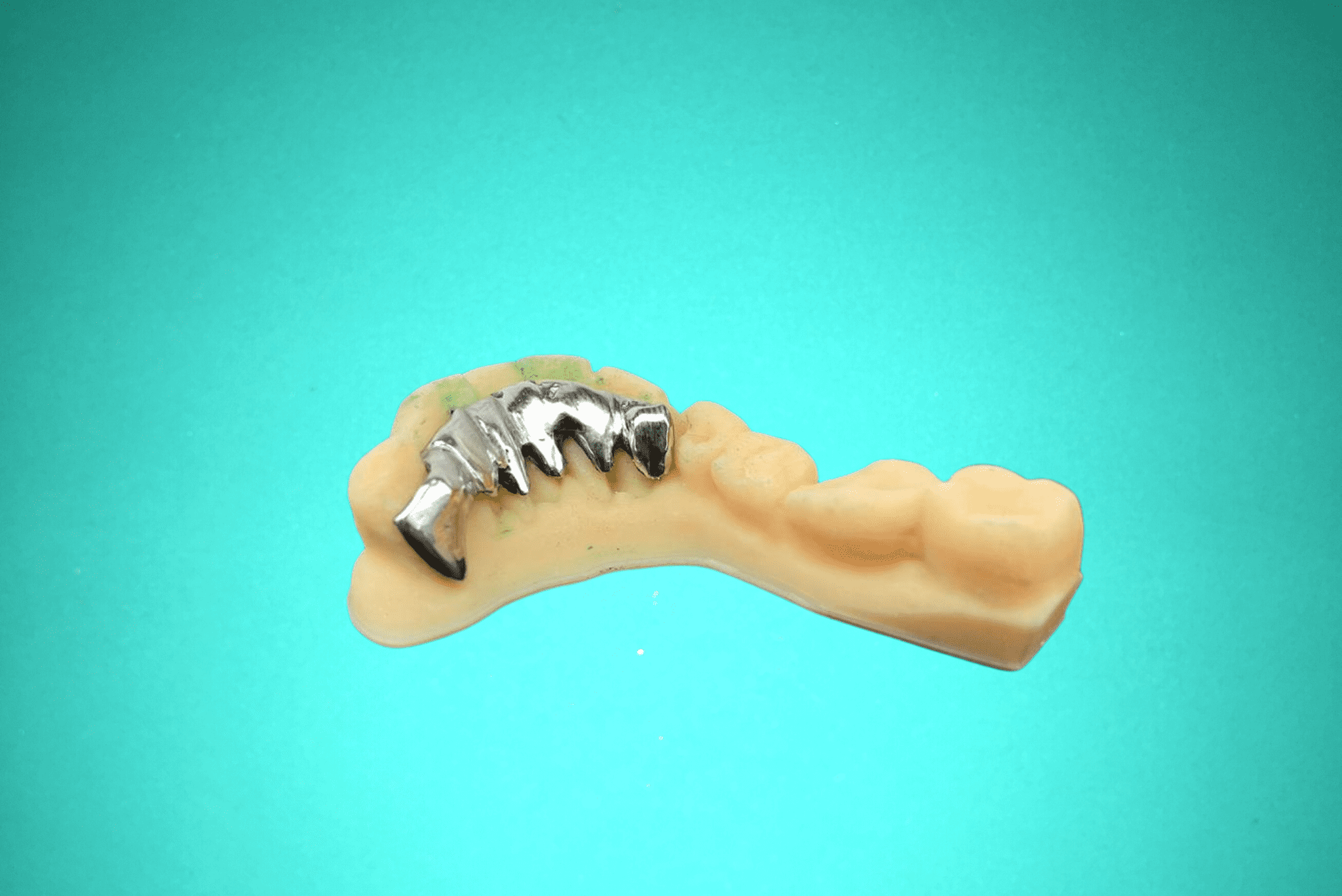 Fil de contention métallique