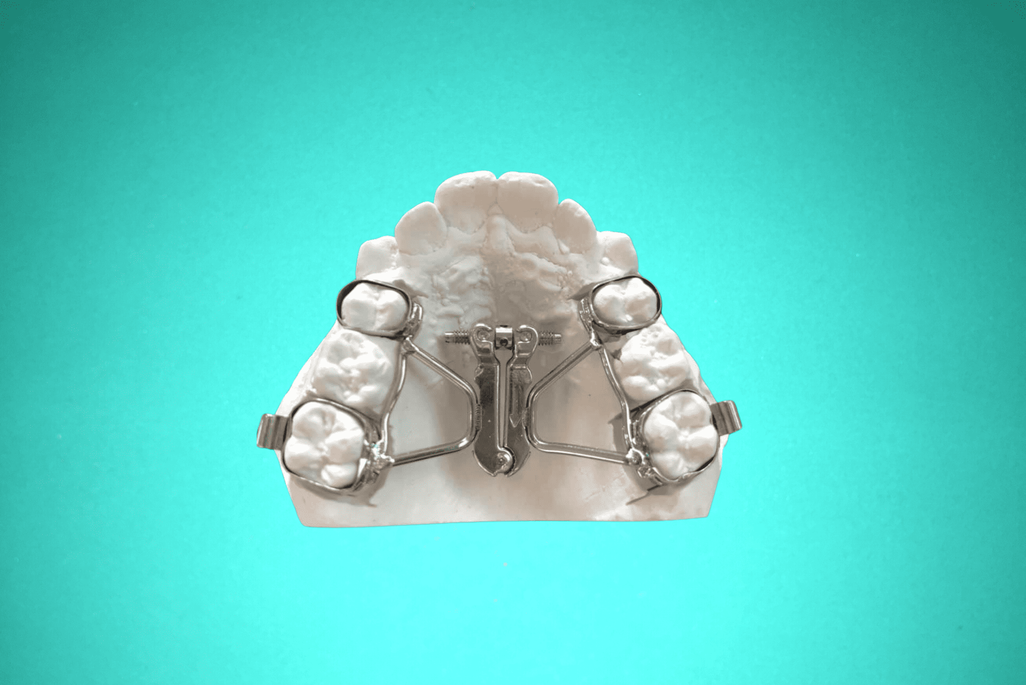 disjoncteur-en-eventail