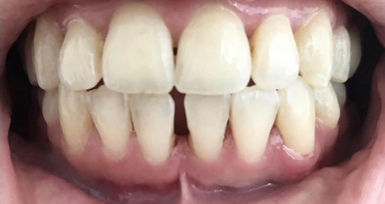 Sans titre (33) Sans titre (33)