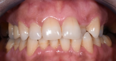 laboratoire-orthodontie-aligneur-invisible-rabat-prothesiste-dentaire-appareils-dentaires-gouttières-4d-ortho.png laboratoire-orthodontie-aligneur-invisible-rabat-prothesiste-dentaire-appareils-dentaires-gouttières-4d-ortho.png