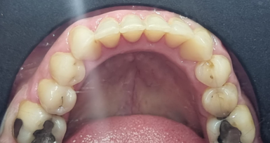 laboratoire-orthodontie-aligneur-invisible-rabat-prothesiste-dentaire-appareils-dentaires-gouttières-4d-ortho.png laboratoire-orthodontie-aligneur-invisible-rabat-prothesiste-dentaire-appareils-dentaires-gouttières-4d-ortho.png