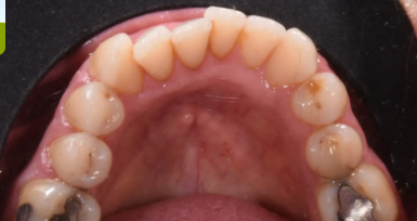 laboratoire-orthodontie-aligneur-invisible-rabat-prothesiste-dentaire-appareils-dentaires-gouttières-4d-ortho.png laboratoire-orthodontie-aligneur-invisible-rabat-prothesiste-dentaire-appareils-dentaires-gouttières-4d-ortho.png